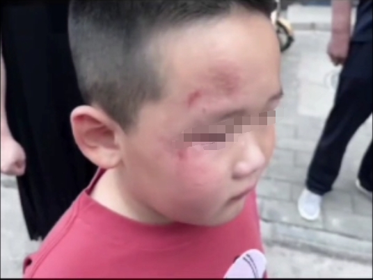 被用不雅言语叫喊后,河北张家口一男子打伤5岁男童,警方:行拘15日