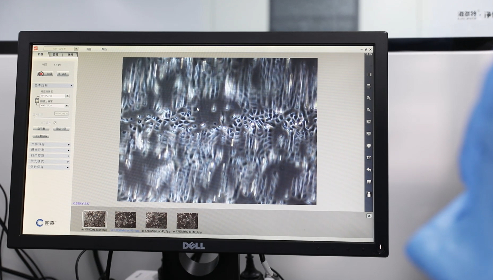 融媒·画像丨济南这个研发团队，为患者造出仿真“皮肤”——“生”皮