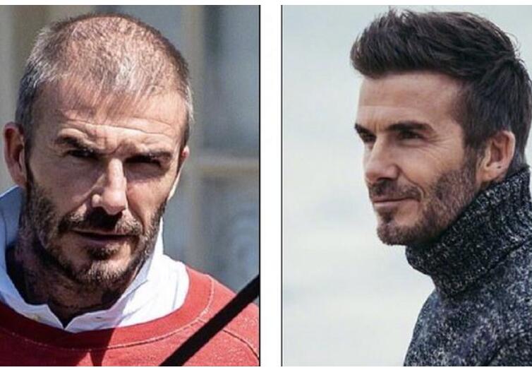 令人唏嘘!45岁贝克汉姆快秃头了 岁月是把剃头刀