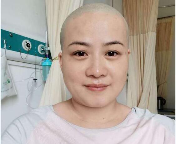 岳云鹏老婆回应生病剃光头到底怎么了?什么病情需要剃光头发?