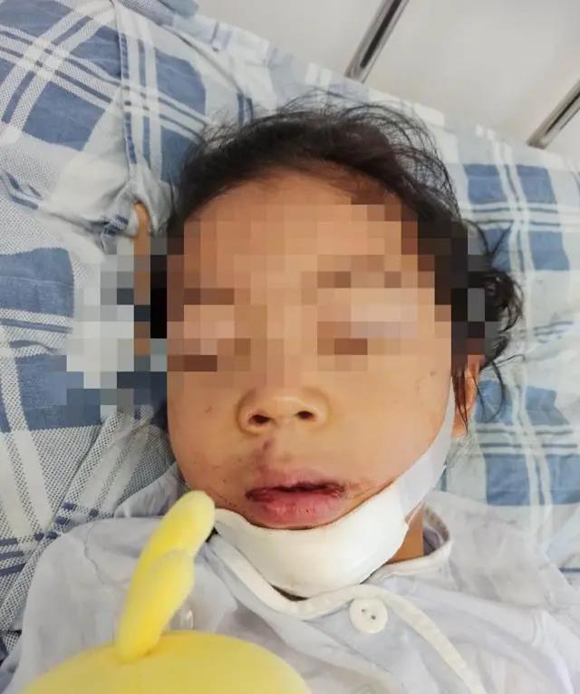 4岁女童被锁幼儿园二楼反思坠楼什么情况?终于真相了,原来是这样!