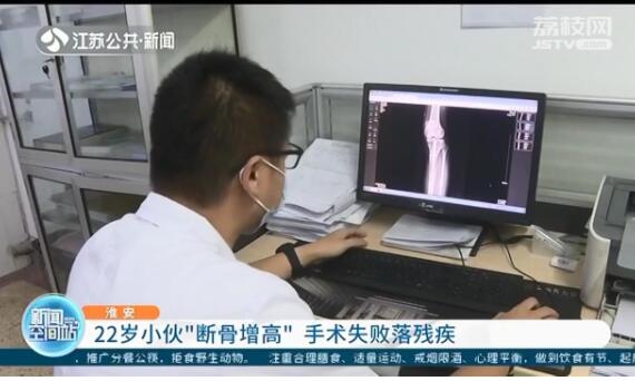 中国断骨增高第一人图片